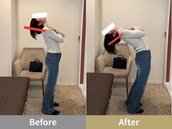 せなかのはね 井尻店/30代　猫背　肩こり　背中の張り