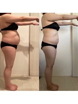 ヨサパーク ユア(YOSAPARK Yua)の写真/【全身サイズダウンを本気で目指すならコレ】自分では落とせない頑固な脂肪を燃焼アタック！痩身/
