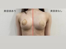 整顔整頭/バスト導入美容液