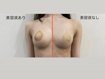 整顔整頭/バスト導入美容液