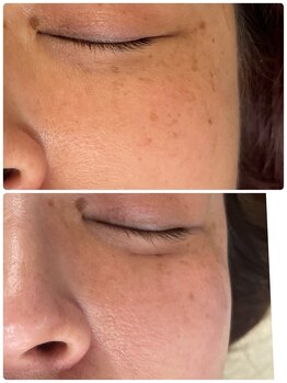 エン(enn)/【トーンアップ・シミ改善】