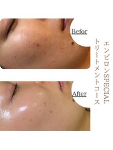 ソワ 恵比寿(soi)/エンビロンフルコース