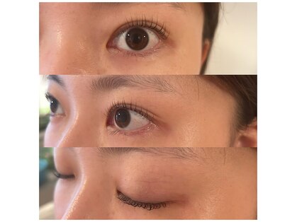 エン(en)の写真