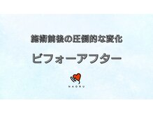 ナオル整体 錦糸町院(NAORU整体)/施術ビフォーアフター