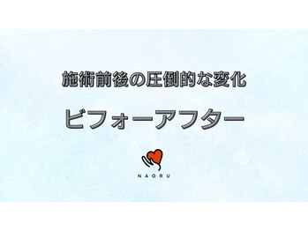ナオル整体 錦糸町院(NAORU整体)/施術ビフォーアフター