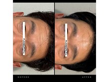 ワイケー(yk)/プラズマ×エクストリュージョン