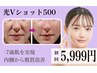 光Vショット500ショット 【剥離なし】 光フェイシャル  《内側肌改善・小顔》