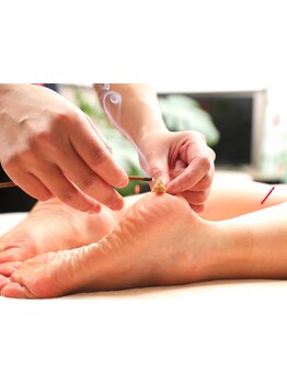 鍼灸施術を受けたい