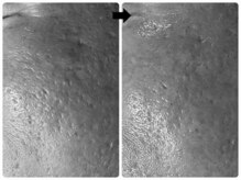 エフェクト 塚口店(effect)/Before After &nbsp;&nbsp;50代/1回目
