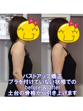 ワイルドボディ(WILD BODY)/バストアップ矯正