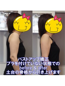 ワイルドボディ(WILD BODY)/バストアップ矯正