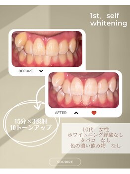 スリール(sourire)/