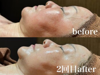 ディアーム 光明池店(Diarm)/