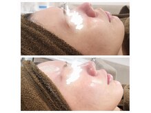 チル アウト(CHILL OUT)の雰囲気（うっとり♪つやんつやんのお肌へ導きます！）