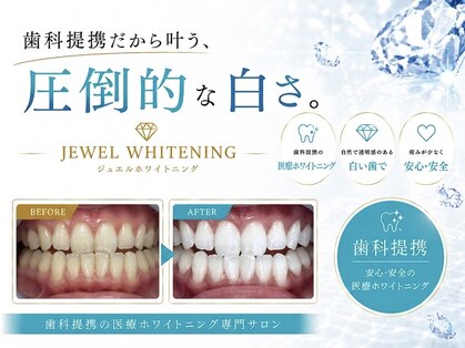 ジュエルホワイトニングの写真