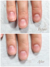 ソワン(soin)/Before→After