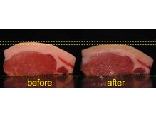 メディカルエステティックサロン リラックスイン(Relaxinn)/