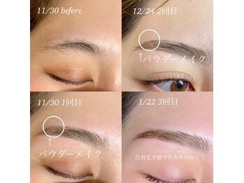 リルモナ(RIREMONA)/