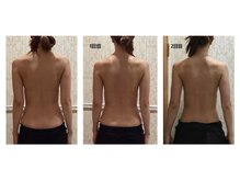 エステサロン ジョアアンジェ(joie ange)/二度で姿勢や肩凝り解消で楽に