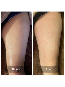 プルトア/年中スリムボディ目指します！