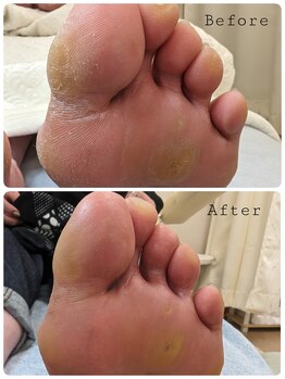 リゼラアンドコー 旭川店/before　after