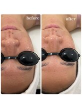 リアム(LiAm)/第4世代ララピール