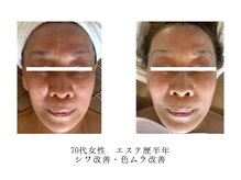 メナードフェイシャルサロン 大津丸の内の雰囲気（初来店時よりも美しく！）