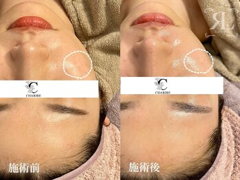 シャリル(charire)/結果重視☆ツヤ肌