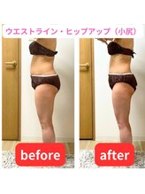 すばる整体院 小牧/痩身エステ/小牧/産後骨盤