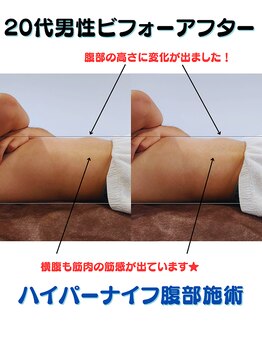 サンシャイン(Sunshine)/20代男性ビフォーアフター