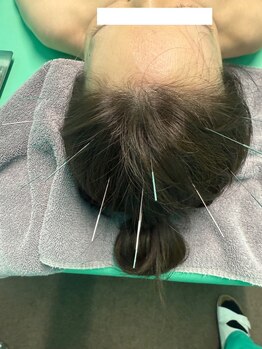 高宮レディース鍼灸整骨院/更年期による不調も対応