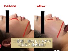 歪んだ箇所をストレッチで緩め、正しい骨・筋肉の位置へと調整◎