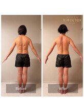 女神デトックス 西宮店(女神DETOX)/ビフォーアフター