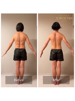女神デトックス 西宮店(女神DETOX)/ビフォーアフター