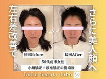 ルルラボ(LuLu beauty labo)/左右差が揃い美人度UP