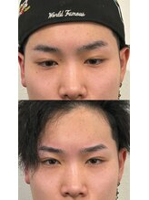 プラチナムブロウ 長岡店(PLATINUM BROW)/美眉スタイリングのお客様　10代