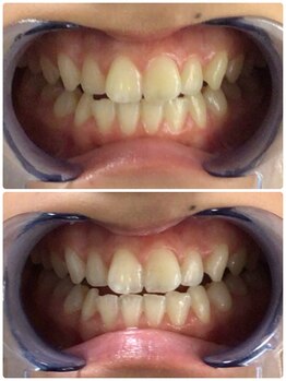 ルルネイル(Lulu Nail)/月一万円で通い放題