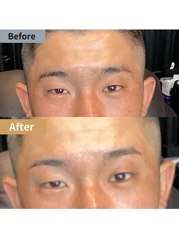 眉毛ハウス 吉祥寺店(眉毛HOUSE)/お客様の施術例(吉祥寺/東京)