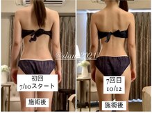 スラン(Slan)/ブライダルボディメイク