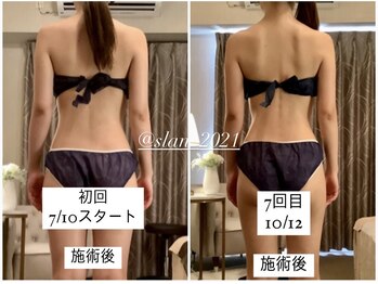 スラン(Slan)/ブライダルボディメイク