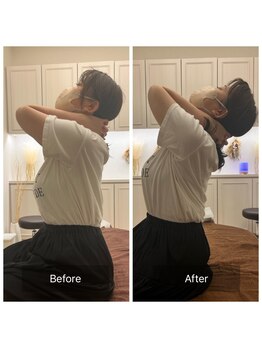 カドル 福岡天神店(KADORU)/オイル整体　Before-After