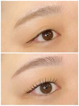 オメメ 八王子(omeme)/before・after