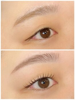 オメメ 八王子(omeme)/before・after