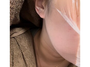 インフィニティ(inFinity)/［美白ケア］美白ピーリング