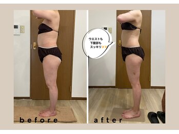 ココロミ(cocoromi)/ハイパーナイフ