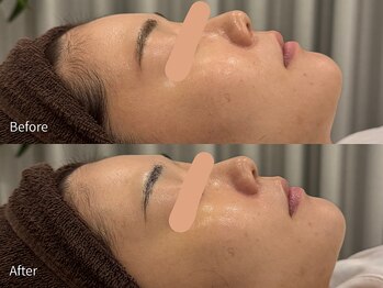 アウラ 小杉店(AULA)/