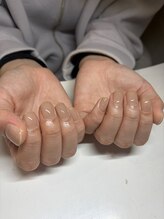 イーミリー(E.milii)/