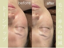 健志接骨院/πテラピー造顔メソッド