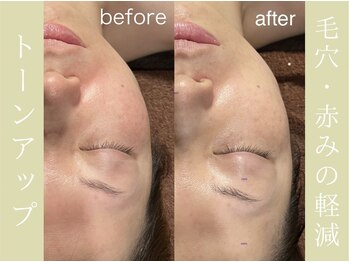 健志接骨院/πテラピー造顔メソッド