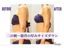 サンク(Thanq)/むくみ太り・上半身・凝り太り